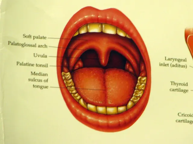 Surgical excision of the tongue: What does the process entail?