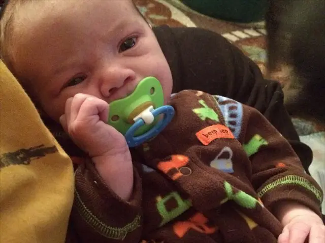 Nourishing an Infant with Flat or Reversed Nipples