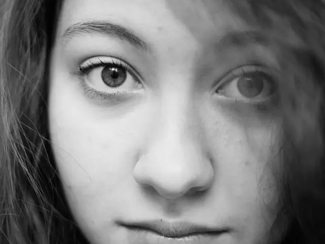 Strategies for Effectively Eliminating Tenacious Blackheads on Your Checks